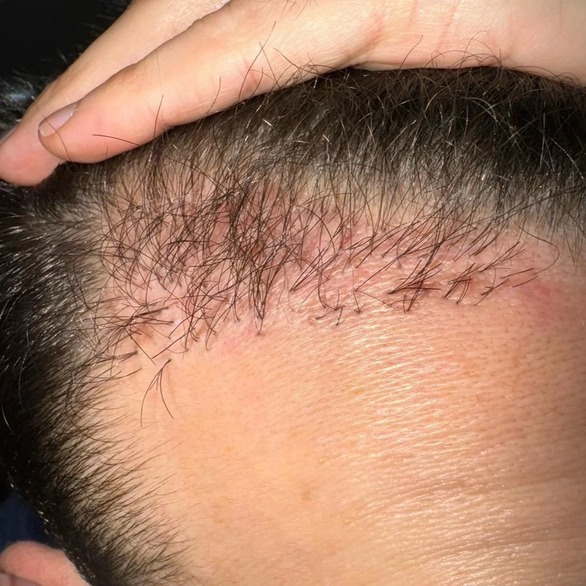 Visible scarring